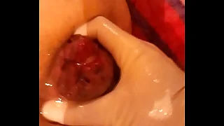 957 fisting porn videos